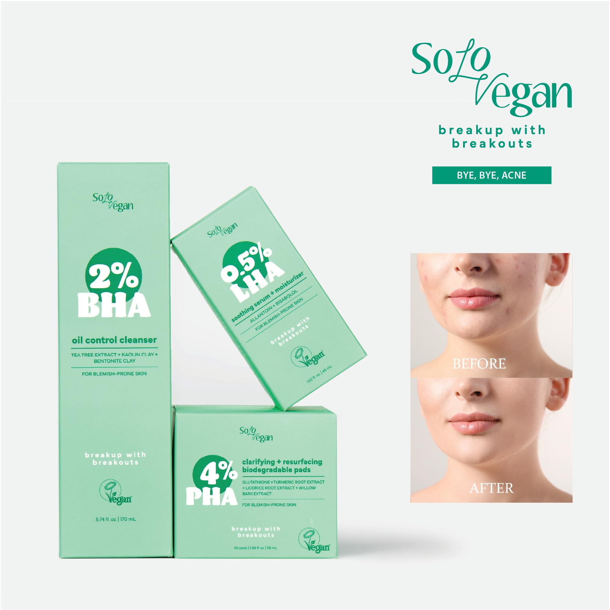 SoloVegan 2% BHA Oil Control Gel Facial Cleanser(170ml), Makeup Remover Cleanser, Korean Skincare