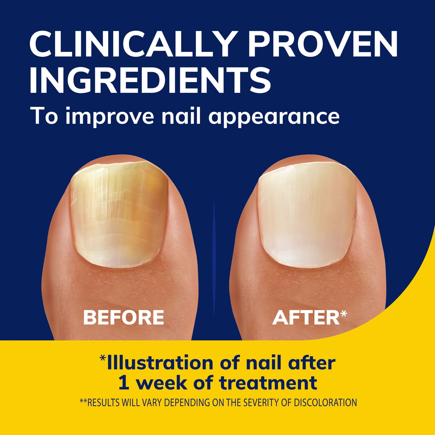 Dr. Scholl's Anti Fungal Nail Treatment Revitalizer Liquid, 0.33 Fl Oz