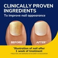 thumbnail image 3 of Dr. Scholl's Anti Fungal Nail Treament Revitalizer, Liquid, 0.33 Fl Oz, 3 of 8
