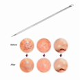 thumbnail image 3 of Stainless Steel Double Ended Acne Needle Beauty Tool for Blackhead Removal - Double Circle Granular Handle, 3 of 5