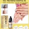 thumbnail image 1 of Clearance Aceites esenciales Aceite de Uñas Uñas Blandas Amarillentas Engrosamiento de Uñas Cóncavas Internas Incrustadas Líquido Brillante para Uñas 10ML Essential Oils, 1 of 9