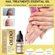 thumbnail image 2 of Clearance Aceites esenciales Elementos esenciales para el hogar Aceite para uñas,uñas suaves,amarillentas,espesantes,cóncavas,internas,incrustaciones,brillo,líquido para uñas,10ML(Buy 2 Save 10%), 2 of 9