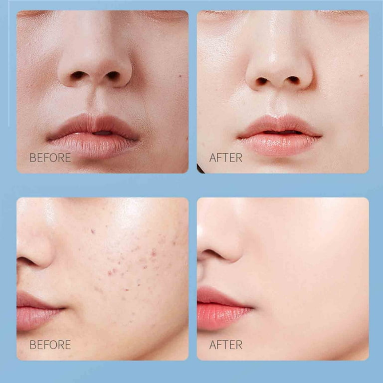 Banghong Crema Facial Blanqueadora Sersanlove, Sersanlove Banghong Crema Facial Blanqueadora Sersanlove, Sersanlove