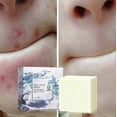 thumbnail image 3 of Anti-mite Soap Handmade Soap Sea Salt Soap Antimite Oil-control And Firming Skin_lucky_b, 3 of 5