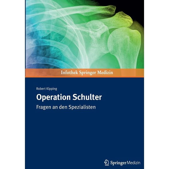 Operation Schulter: Fragen an Den Spezialisten, (Paperback)