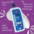 thumbnail image 4 of Clean & Clear Blackhead Clearing Oil Free Cleanser 200ml, 4 of 5