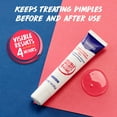 thumbnail image 5 of Clearasil Salicylic Acid Rapid Rescue Acne Spot Treatment Gel, 1 oz, 5 of 11