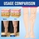thumbnail image 4 of Crema para varices Renhe Ingenuity para piernas (2 unidades), 4 of 8
