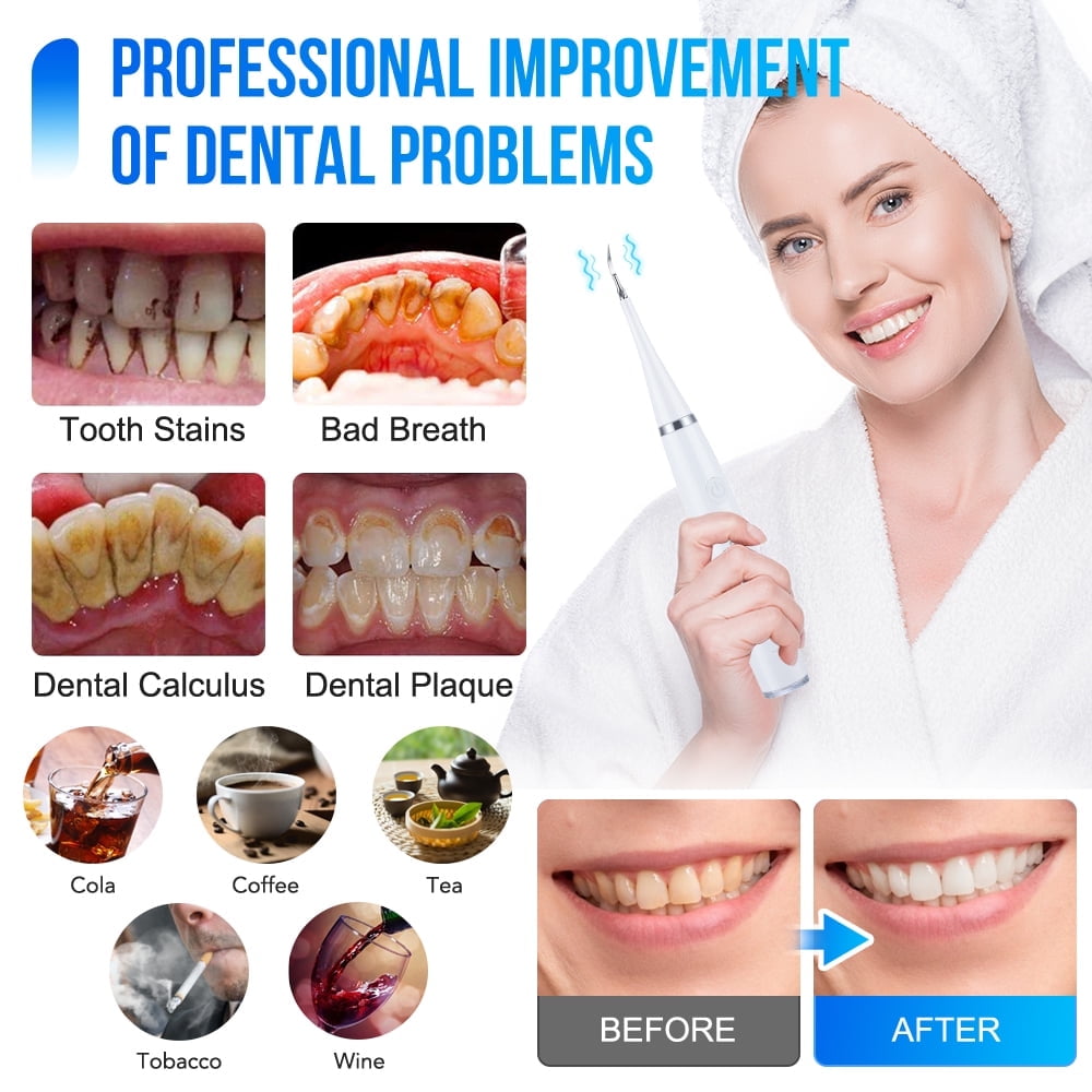 Flaremore Plaque Remover for Teeth,Rechargeable Electric Toothbrush,Water Dental Flosser Pick for Teeth 6-in-1 Electric Tooth Cleaner, Cordless Portable Waterproof Oral Irrigator White