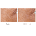 thumbnail image 6 of No7 Laboratories Line Correcting Booster Serum with Collagen Peptides for Wrinkles, Anti Aging, 0.5 oz, 6 of 13