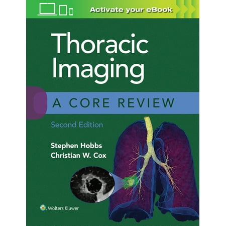 UPC: 9781975126223 | Core Review: Thoracic Imaging: A Core Review (Paperback)