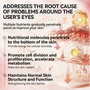 Rose Eye Mask Eye Patches 60 Pcs Puffy Eyes Dark Circles Reduce Wrinkles and Fine Lines Undereye