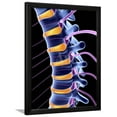 thumbnail image 1 of Spine And Spinal Nerves,computer Artwork, Framed Art Print Wall Art by PASIEKA Sold by Art.Com, 1 of 5