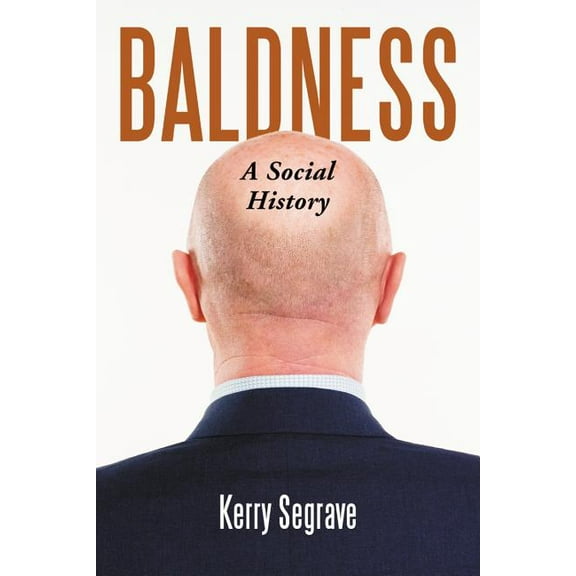 Baldness: A Social History (Paperback)