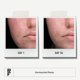 thumbnail image 2 of Régimen impecable de Rodan + Fields | Limpiador facial con peróxido de benzoilo para piel sensible | Sets y kits de cuidado de la piel | Cuidado de la piel para adultos y adolescentes con acné persist, 2 of 6