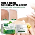 thumbnail image 1 of XWSHYW Cremas Hidratantes Crema para Glúteos y Muslos, Crema Corporal, Eliminación y Pelos Encarnados para Glúteos, Muslos, Espalda y Pecho, y Quístico 110G, 1 of 6