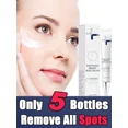 thumbnail image 2 of Crema blanqueadora Facial que elimina las manchas y pecas de la edad de melanina, reduce la luminosidad, hidrata, ilumina el cuidado Facial, 2 of 5