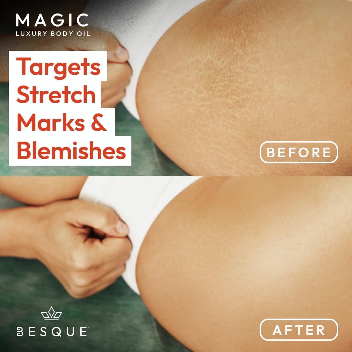 Besque Magic Body Oil, 3.4 FL OZ, After Shower Body Oil For Women, Hydrating Skin Care For Full Body That Plumps, Tightens, and Firms Skin With Natural Ingredients, Luxury Spa Gifts - Pack of 4