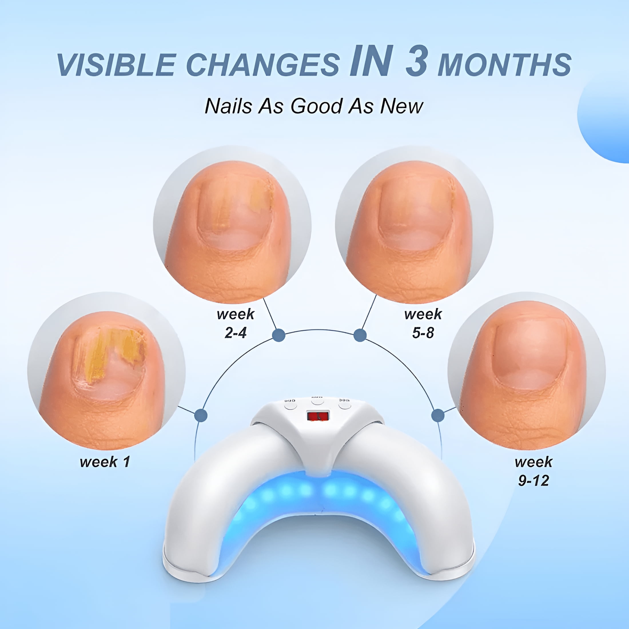 XIRQI Nail Fungus Laser Treatment Device for Multiple Toenail, Home Use 905nm Infrared Light + 470nm Blue Light UV Nail Lamp Professional Nail Dryer
