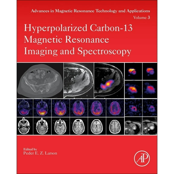 Advances in Magnetic Resonance Technolog Hyperpolarized Carbon-13 Magnetic Resonance Imaging and Spectroscopy: Volume 3, Book 3, (Paperback)