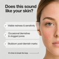 thumbnail image 4 of Suero facial NINELESS 30 ml Ácido azelaico + Niacinamida, 4 of 9