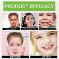 thumbnail image 5 of Teething Relief Roller Essential Oil for Babies, Teething Roller Natural Pain Relief Roll-On Essential Oil, 5 of 5