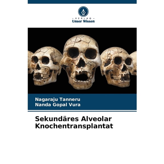 Sekundäres Alveolar Knochentransplantat, (Paperback)