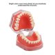 thumbnail image 4 of Modelo de encía ANGGREK Dientes removibles, 4 of 8