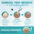 thumbnail image 5 of Ebanel Athletes Foot Fungus Treatment Extra Strength with Miconazole, Undecylenic Acid, Tea Tree Oil, Herbal Remedies, Antifungal Cream for Skin to Kill Fungi Lead to Nail Fungus, Ringworm, Jock Itch, 5 of 5