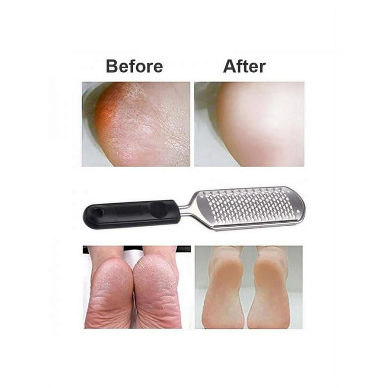 Foot File, Premium Stainless Steel Foot Rasp File Callus Remover  Professional Foot Scrubber - Colossal Foot Rasp and Dual Sided Foot File 