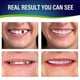 thumbnail image 3 of Nuevos 2 juegos de prótesis dentales, prótesis dentales de mandíbula superior e inferior, naturales y cómodas, protegen los dientes y recuperan una sonrisa segura Feliz Sencillez, 3 of 3