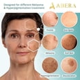thumbnail image 4 of ABERA Melas Sérum Anti-Taches, 4 of 7