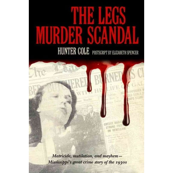 Legs Murder Scandal (Paperback)
