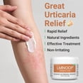 thumbnail image 3 of Urticaria Cream for Hives Relief - Fast Acting Anti Itch Treatment with All Natural Herbal Formula for Skin Allergic Rashes, Redness, Swelling 3.53 oz, 3 of 8