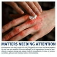 thumbnail image 3 of Hand And Foot Chapped Repair Cream 30g, 3 of 3