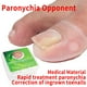 thumbnail image 3 of Herramienta de Tratamiento de Paroniquia Jinwen Corrector de Uñas Encarnadas, 3 of 8
