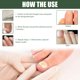 thumbnail image 4 of Toenail care aceite esencial, Yanshi solución reparadora de uñas 3ml con un puntero láser para el tratamiento de hongos unisex Yanshi Toenail care aceite esencial, 4 of 6
