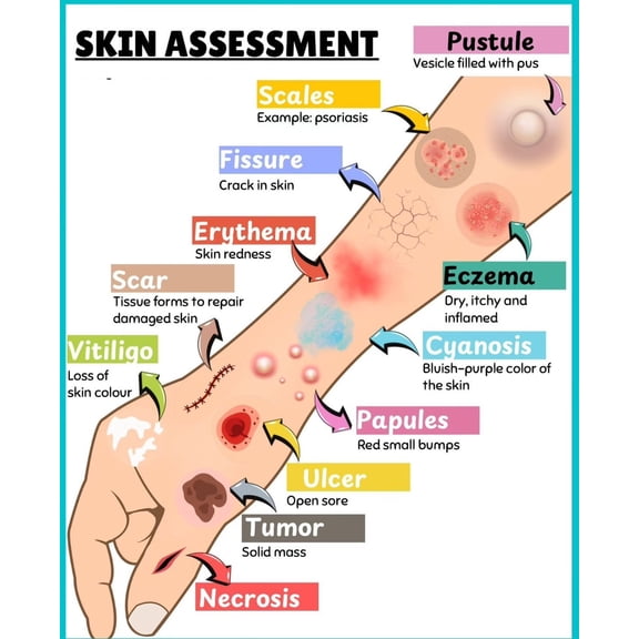 SKIN ASSESSMENT Poster Suitable for medical education posters for students, and can also be used as classroom and hospital office decoration poster