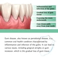thumbnail image 5 of QARUN Regrowth Drops for Receding Gums,Oil Pulling,Gum Restore Drops,Gum Repair for Receding Gums for Teeth and Gums,Rejuvenate Your Gums with Ease-30Ml, 5 of 7