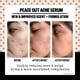 thumbnail image 4 of Serum Peace Out Skincare Acne 2% Ácido Salicílico 30 ml, 4 of 6