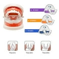 thumbnail image 4 of Orthodontic Braces Dental Braces Smile Teeth Alignment Trainer Instanted Silicone Teeth Retainer Mouth Guard Braces Tooth Tray, 4 of 4