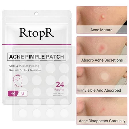 Hydrocolloid Acne Pimple Patch for Zits And Blemishes, Spot Treatment Stickers for Face And Skin, Vegan And Cruelty Free