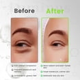 thumbnail image 4 of Luminus Ultra 2% Salicylic Acid Face Serum, BHA Liquid Exfoliant for Acne Prone & Oily Skin | For Women & Men | 1 Fl Oz/30ml, 4 of 8