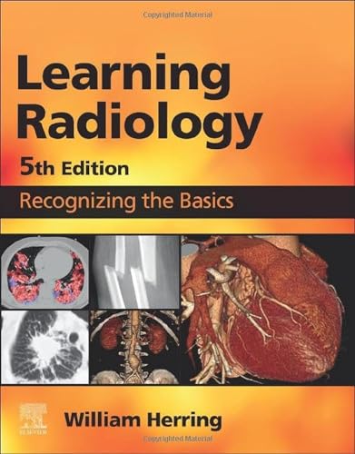 Learning Radillogy Pre-Owned Learning Radiology: Recognizing the Basics Paperback ...