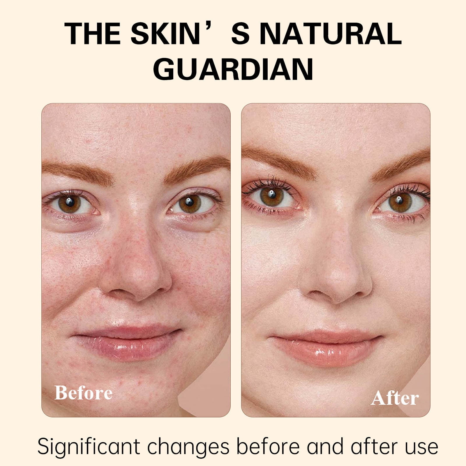Nourish Max Skin Products Beauty & Personal Care Owned Beard Products for Men Men's Moisturizer head Face Wash Remover Skin Filler for Deep Forehead Remover X Candy Skin