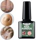 thumbnail image 5 of Nail Fungal Treatment 15ml Nails Supplies Nails for Nail Cracking Colco Tratamiento de hongos en las uñas, 5 of 8