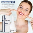 thumbnail image 4 of Jaysuing Tartar Dissolving Mouth Spray Removes Bad Breath Tartar Lasting Fragrance Dissolves Tartar |, 4 of 5
