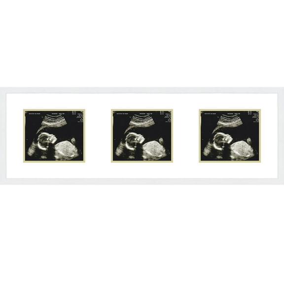 16x5 White Sonogram Frame with White on Yellow Mats with 3 Openings to Display 3 4x3 Sonograms -
