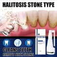 thumbnail image 3 of Spray desodorizante para disolver cálculos dentales, 30 ml | HUOGUO, 3 of 5