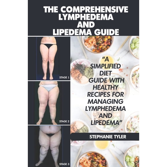 The Comprehensive Lymphedema and Lipedema Guide, (Paperback)